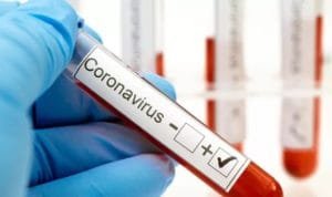 WhatsApp Image 2020-05-27 at 13.13.18 WhatsApp Image 2020 05 27 at 13.13.18