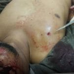 WhatsApp Image 2020-06-27 at 16.56.39 (1) WhatsApp Image 2020 06 27 at 16.56.39 (1)