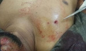 WhatsApp Image 2020-06-27 at 16.56.39 (1) WhatsApp Image 2020 06 27 at 16.56.39 (1)